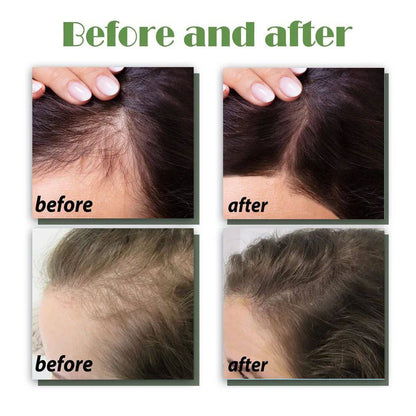 Aceite, para la caída del cabello