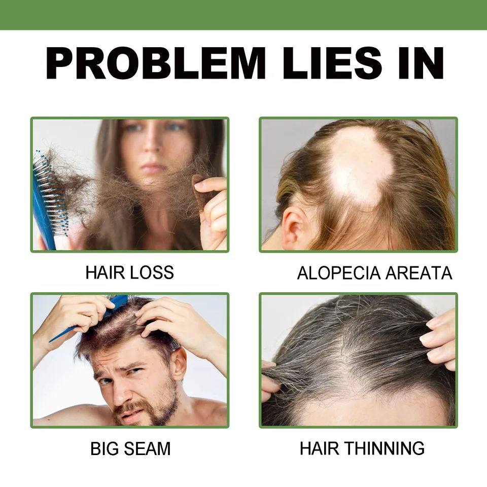 Aceite, para la caída del cabello